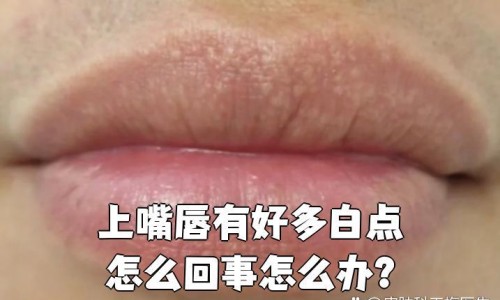 月经期黑色血是什么原因-月经期黑色血是什么原因、月经期间黑色怎么办呢 -月经期间黑色怎么办网